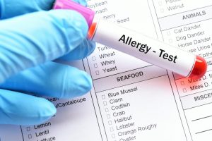 testy alergologiczne