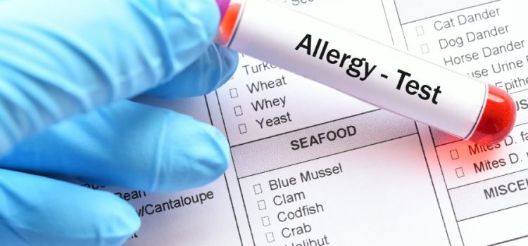 5 zalet nowoczesnej diagnostyki alergii